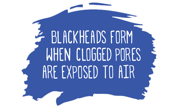 what is blackhead