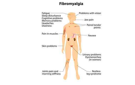 Causes of fibromyalgia
